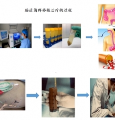 尊嘟尊嘟！屎也能治病了，速看治疗方式→