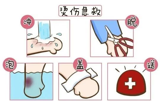【健康科普】烫伤急救必学！家庭处理