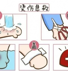 【健康科普】烫伤急救必学！家庭处理