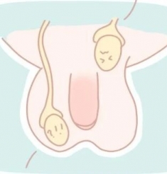 【健康科普】小蛋蛋“失踪”之谜：关于隐睾，家长必须知道的5件事